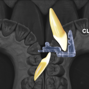 Unwind MD (Muscle Deprogrammer) - Image 3