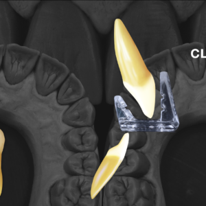 Unwind MD (Muscle Deprogrammer) - Image 2